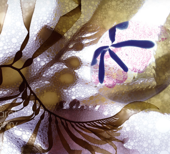 Anenome